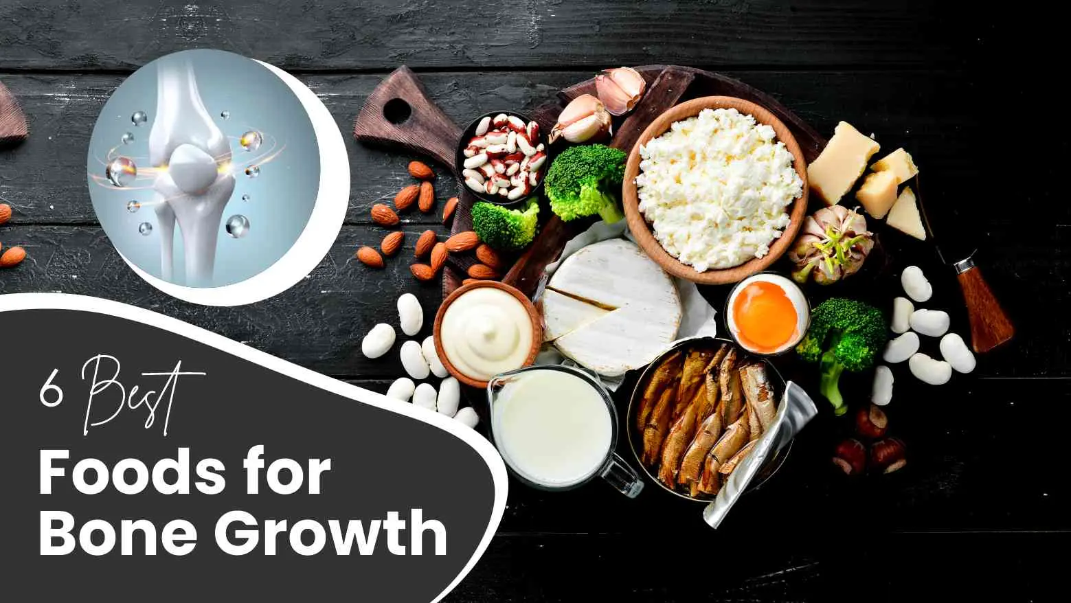 6 Best Foods for Bone Growth: Simple Diet Tweaks for Lifelong Bone Health