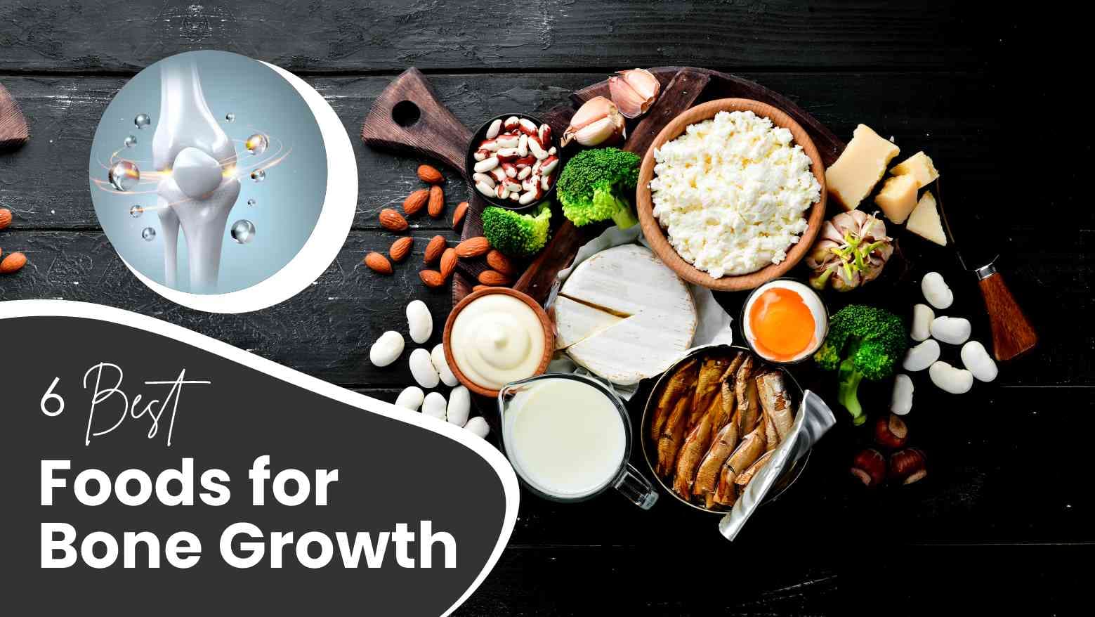 6 Best Foods for Bone Growth